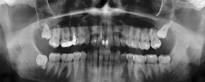 ad_services_0001s_0000s_0000_dental-x-rays